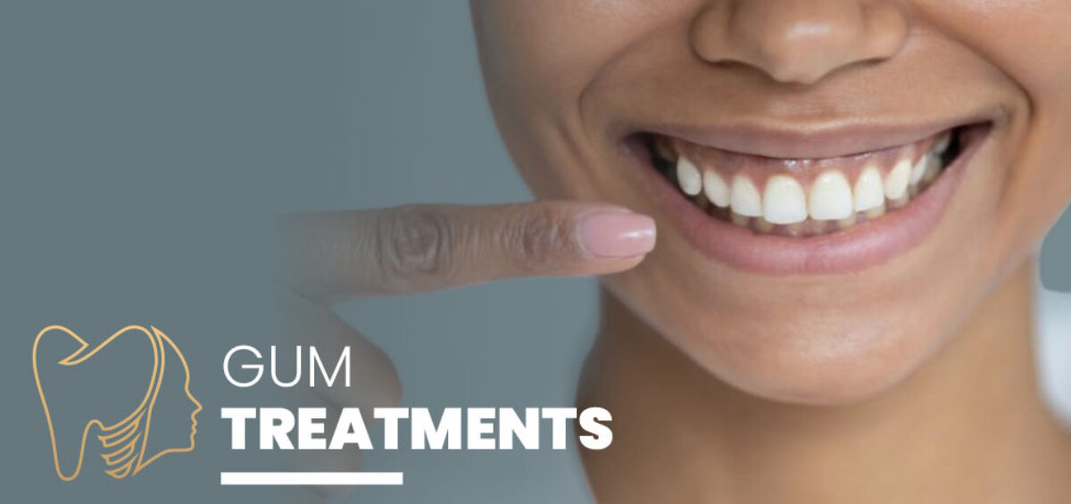 dental-gum-treatments-dorset-hampshire