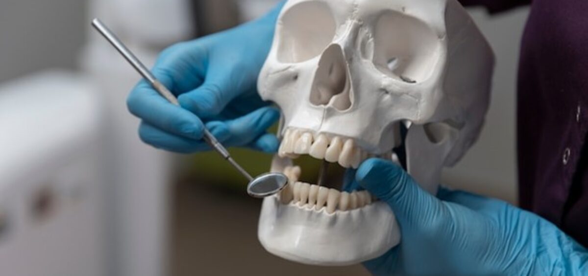 Zygomatic Implants: The Ultimate Solution for Severe Bone Loss