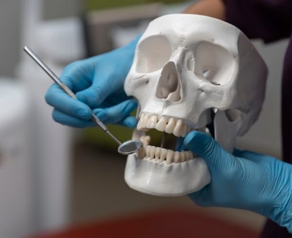 Zygomatic Implants: The Ultimate Solution for Severe Bone Loss