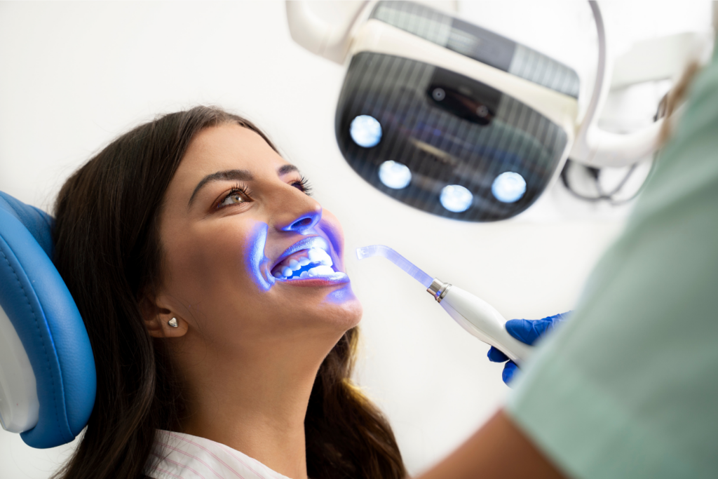 Why Professional Teeth Whitening Works Better