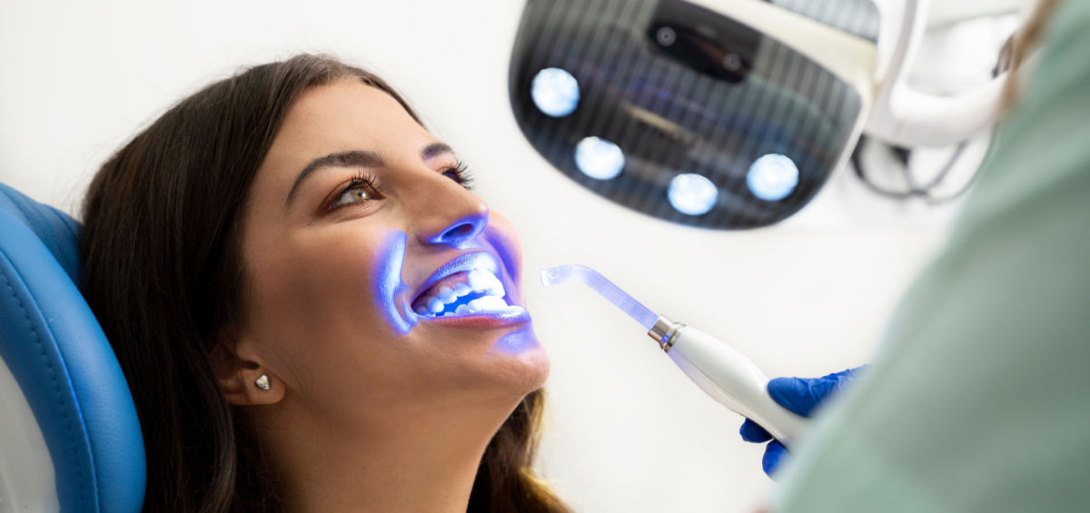 Why Professional Teeth Whitening Works Better