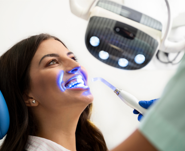 Why Professional Teeth Whitening Works Better