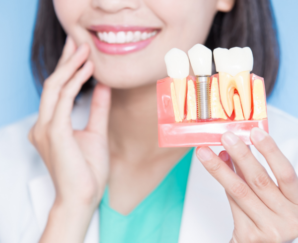 Do Dental Implants Look and Feel Like Natural Teeth?